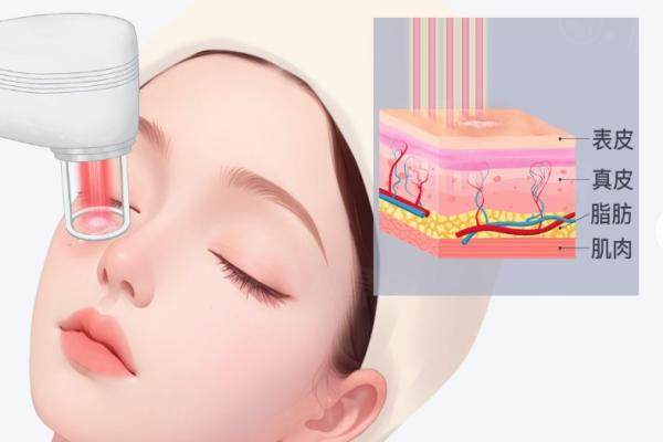 深圳做人中縮短術(shù)好的醫(yī)生是誰