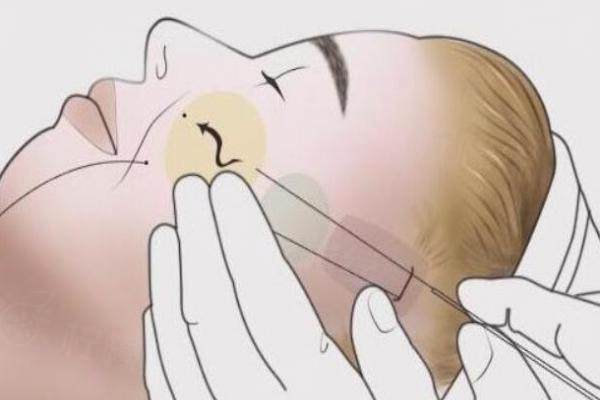 楊俊和黃寅守的手術(shù)費(fèi)用分別是多少