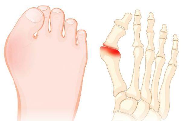 馬桂文大腳骨真的有那么神奇嗎
