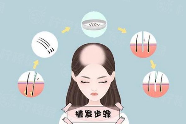 成都恒美植發(fā)總店地址