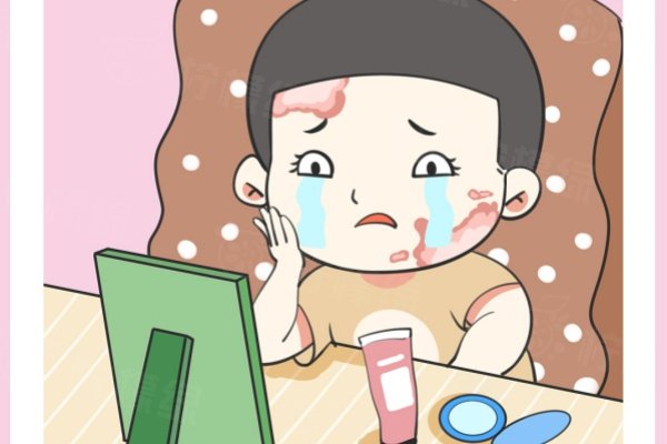 成都恒美植發(fā)醫(yī)生推薦