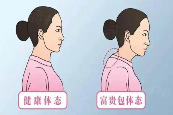 李方偉富貴包收費(fèi)明細(xì)