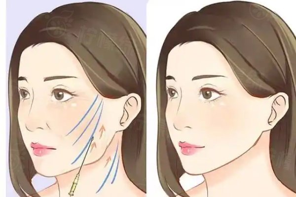 荊門中翰整形醫(yī)院口碑怎么樣