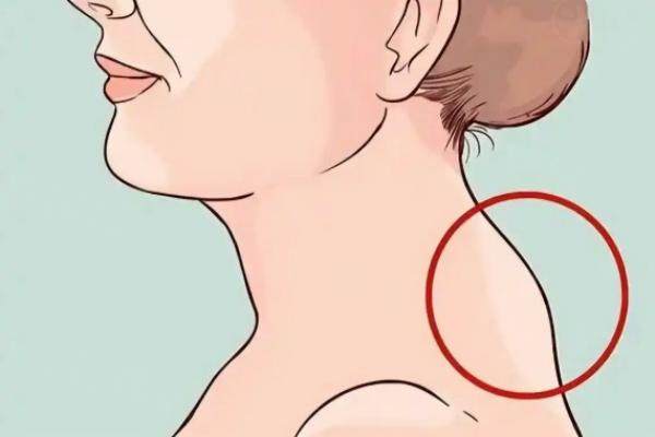 李方偉做富貴包手術(shù)安 全嗎