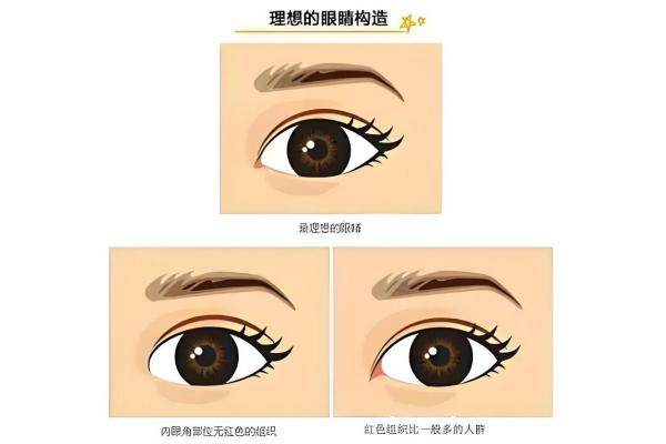 許炎龍做雙眼皮怎么樣？ 獨(dú) 家帕克式重瞼術(shù)技術(shù)解析，附2025價(jià)格與真人案 例！3